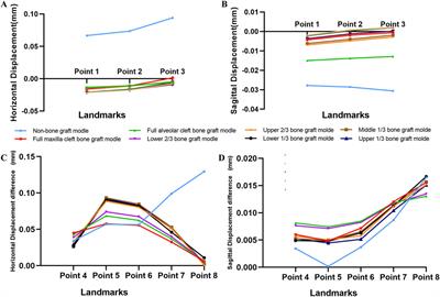 Finite element analysis of maxillary orthodontic therapies with variable alveolar bone grafts under occlusal forces in patient with unilateral cleft lip and palate